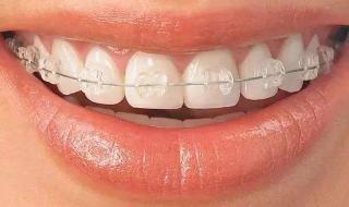 什么是透明图片 什么是透明图片